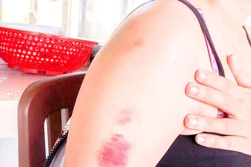 Bà bầu bị đánh động thai vì chậm trả tiền lãi