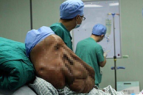 Người đàn ông có khuôn mặt dài tới lưng vì mắc bệnh hiểm nghèo