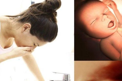 Bác sĩ trả lời: Mẹ phù nề chân tay và cân nặng bé có liên quan?