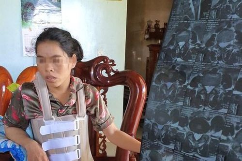 Quảng Bình: Khởi tố người chồng hành hung vợ suốt 11 năm