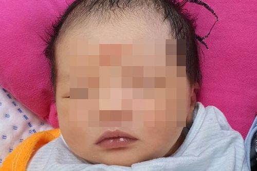 Cứu thai nhi suýt chết trong bụng mẹ