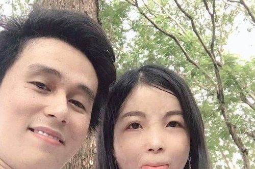 Chàng shipper ưa nhìn quyết cưới bằng được cô gái có gương mặt đầy sẹo