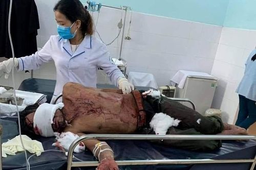 Tin mới vụ người đàn ông bị gấu rừng tấn công ở Quảng Nam