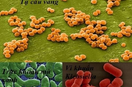Trải qua 7 lần mổ sau gãy xương, tiên lượng vẫn xấu do kháng thuốc