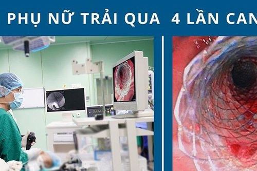 Cứu sống cụ bà bị ung thư đường mật ngoài gan nguy hiểm
