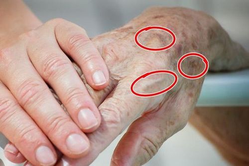 7 bộ phận bên ngoài cơ thể tiết lộ tuổi thật