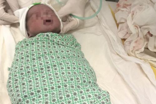 Hà Nội: Hy hữu sản phụ sinh đôi cách nhau 8 tuần, một bé còn sống, khỏe mạnh