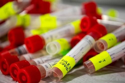 Nóng: Thêm 2 biến chủng mới của virus SARS-CoV-2 được phát hiện