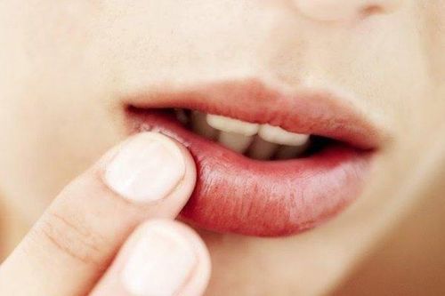 Thấy môi có hiện tượng này, đi khám ung thư miệng ngay kẻo hối hận