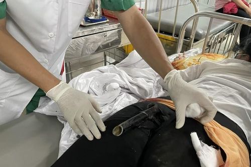 Va chạm giao thông bị chân chống xe máy đâm dính vào mông