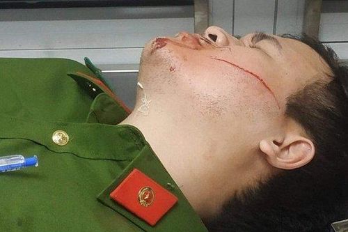 Đà Nẵng: Hai công an bị chém khi khống chế đối tượng dọa giết người