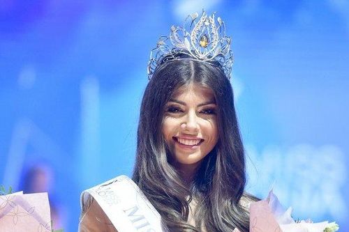 Màu mắt độc lạ của tân Hoa hậu Ba Lan