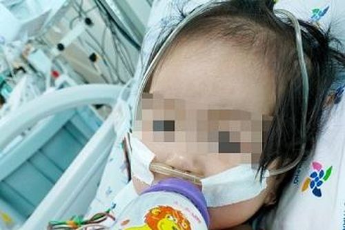 Cứu bé gái nguy kịch do biến chứng tay chân miệng