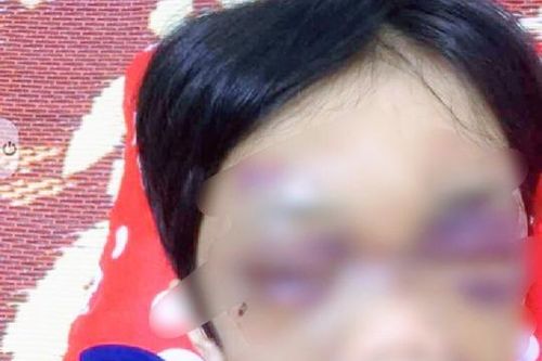Hải Dương: Khởi tố người mẹ hành hạ con đẻ dã man