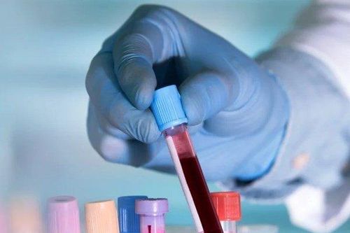 Người thuộc nhóm máu này nên thận trọng vì có nguy thư mắc ung thư cao