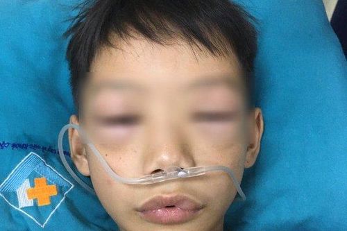 Cứu sống bé trai 10 tuổi bị sốc phản vệ nặng do uống thuốc tự mua