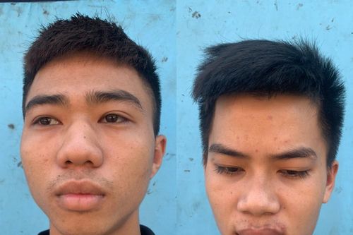 Khởi tố 3 đối tượng nghiện ma túy gây ra 10 vụ trộm cắp tài sản