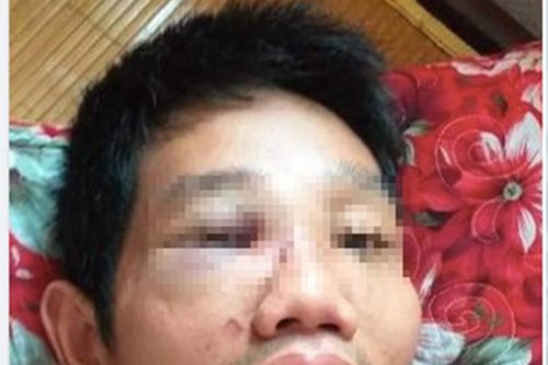 Mâu thuẫn tại chốt kiểm dịch, một cán bộ bị đánh nhập viện