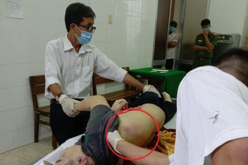 Bị can chết khi đang tạm giam ở Tiền Giang, thi thể có nhiều vết bầm tím