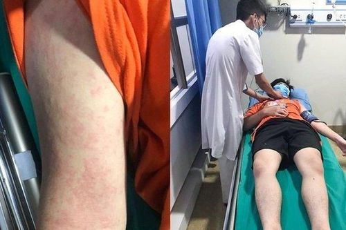 Thiếu niên 16 tuổi suýt mất mạng sau khi ăn con mối