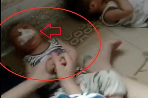 Yêu cầu xác minh và xử lý vụ 'nhét giẻ vào miệng trẻ mầm non'