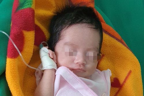 Nghệ An: Phẫu thuật thành công cho bé sơ sinh có đường ruột nằm ngoài ổ bụng
