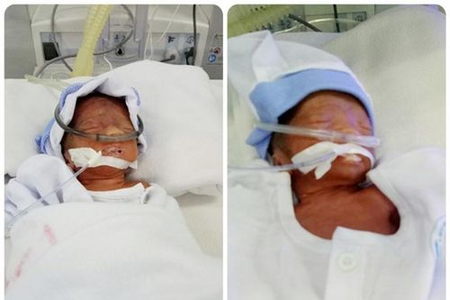 An Giang: Cách ly xã hội, Thượng úy Công an phường dùng xe chuyên dụng đưa sản phụ đi sinh