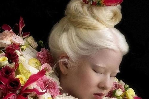 Vẻ đẹp kỳ lạ của người mẫu bạch tạng vốn là bé gái bị cha mẹ vứt bỏ
