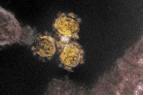 Người nhiễm biến thể Delta có tải lượng virus cao gấp 300 lần so với nhiễm virus SARS-CoV-2 gốc