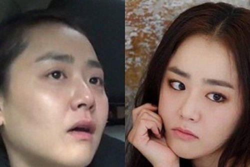 Moon Geun Young 'em gái quốc dân' đình đám xứ Hàn từng sa sút vì bệnh tật