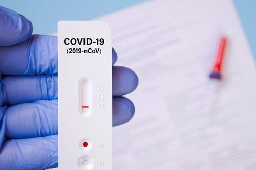Bộ Y tế đề nghị báo cáo giá test xét nghiệm Covid-19 trước ngày 17/10
