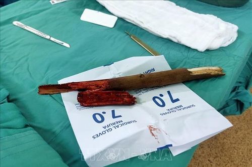 Cấp cứu thành công bệnh nhân bị cành cây đâm vào cổ