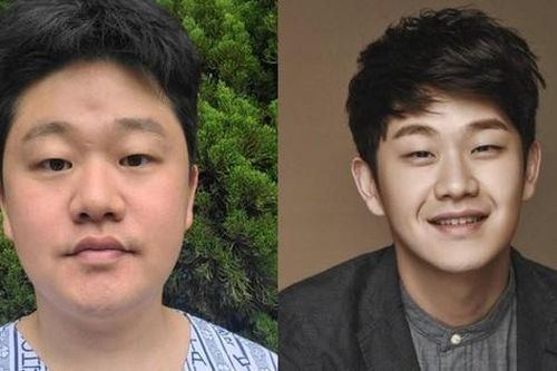 'Rung chấn' Hàn Quốc khi một 'hiện tượng âm nhạc' lừa dối bị ung thư để 'trục lợi' lòng thương cảm
