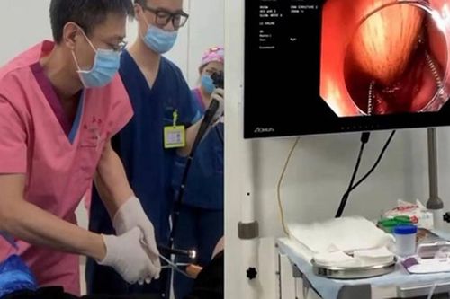 Bị táo bón, chàng trai thông ruột bằng cách kinh dị...nhập viện gấp