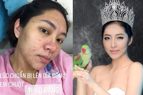 Nghị lực như Hoa hậu Đặng Thu Thảo: Từ nhan sắc bị mụn tàn phá khi mang bầu đến bản lĩnh trước đổ vỡ hôn