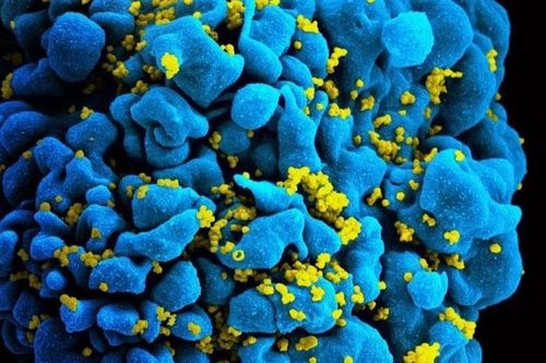 Phương pháp chữa HIV đột phá sắp được thử nghiệm trên người