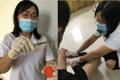 Kinh hoàng cảnh 'lôi' giun dài từ... đùi do tiết canh sống