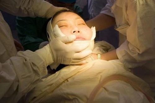Người phụ nữ Trung Quốc phẫu thuật thẩm mỹ để tránh vận xui cho chồng