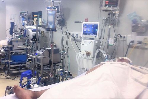 Bệnh nhân Covid-19 đầu tiên của Sóc Trăng phải ECMO là cô gái 23 tuổi