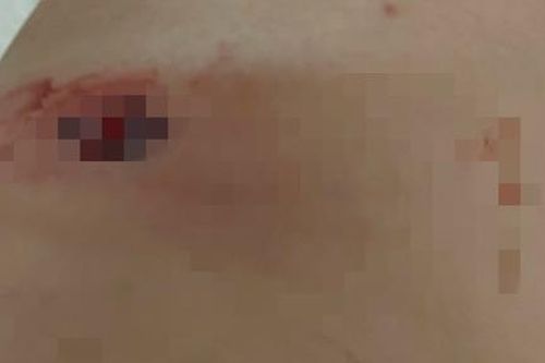 Vụ người đàn ông bị bắn nhiều phát đạn: Công an khởi tố vụ án