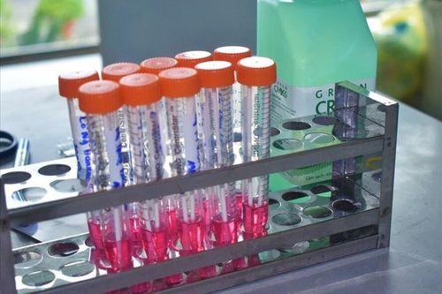 Giá xét nghiệm SARS-CoV-2 mỗi nơi một khác, Bộ trưởng Y tế lý giải nguyên nhân