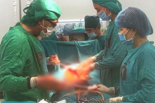Cấp cứu kịp thời bệnh nhân bị cây gỗ đập vào bụng trong lúc lao động