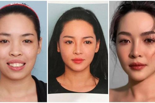 Nhan sắc 'hotgirl phẫu thuật thẩm mỹ' Vũ Thanh Quỳnh thay đổi ra sao sau 7 năm đổi đời?