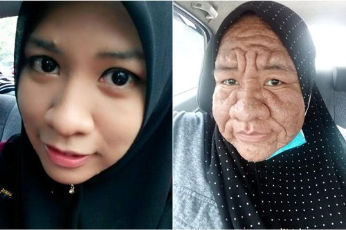 Tỉnh dậy sau một đêm, gái xinh bỗng hóa thành bà lão 70 tuổi, nguyên nhân khiến nhiều người ngỡ ngàng