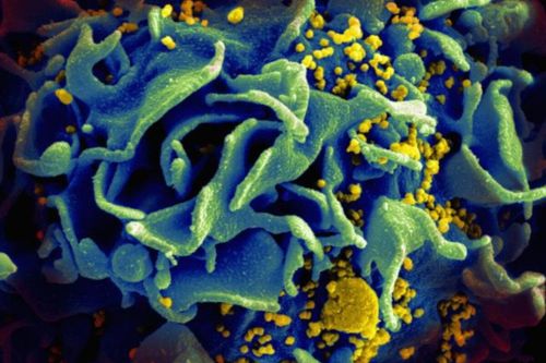 Người phụ nữ 30 tuổi tự hết virus HIV dù không điều trị