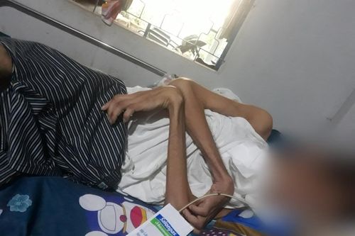 Vụ 'Bị đánh chết não, vẫn không khởi tố': Chuyển kết luận điều tra sang Viện Kiểm sát đề nghị truy tố