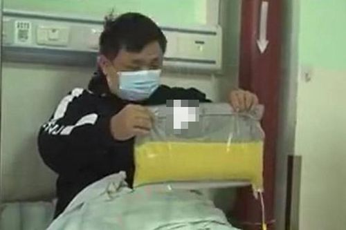 Ăn gà rán mỗi tối, bệnh nhân 'dọa' bác sĩ sợ chết khiếp