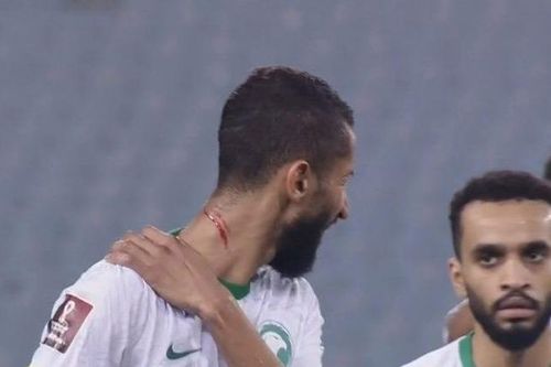 Saudi Arabia bức xúc Tuấn Anh chỉ bị thẻ vàng dù làm chảy máu cổ Al-Faraj