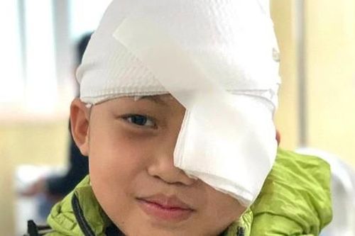 Cậu bé có khối u 'khủng' ở mắt trái đã khóc khi nhìn thấy mẹ sau ca phẫu thuật thành công