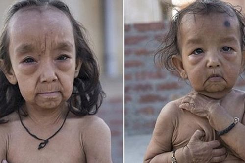 Cuộc sống của những đứa trẻ trông già hơn cả cha mẹ